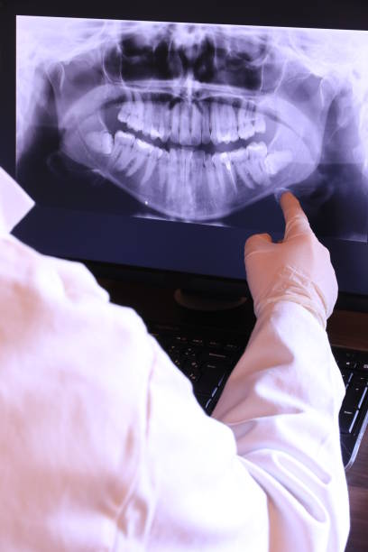 Best Emergency Dental Extractions in Piperton, TN