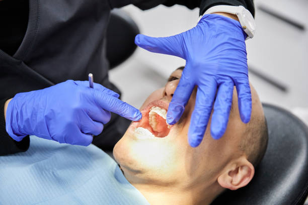 Best Emergency Dentist for Knocked-Out Tooth in Piperton, TN